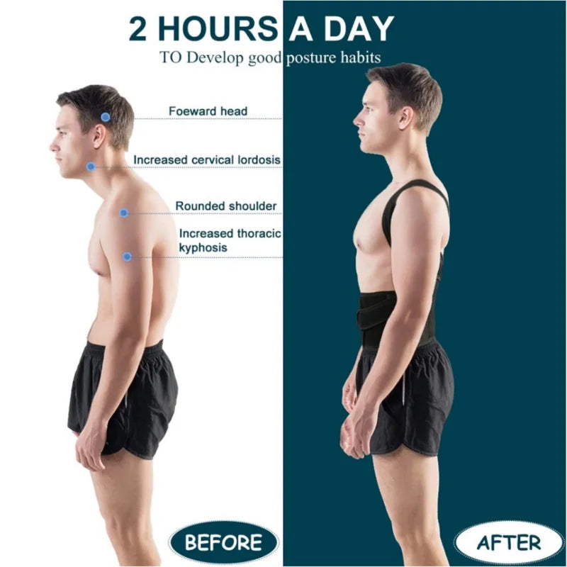 Adjustable Posture Corrector – Daily Back & Shoulder Support
